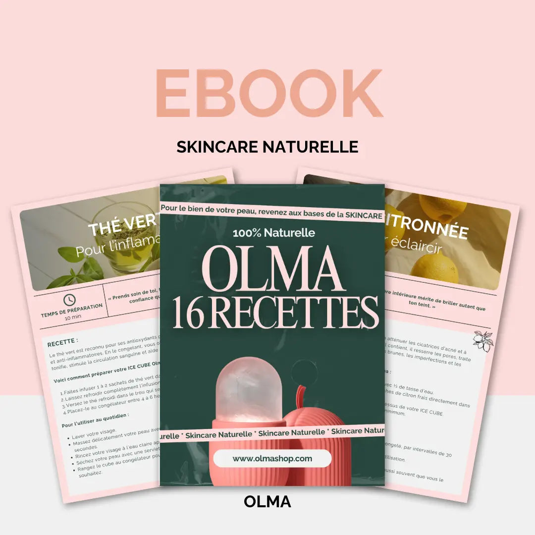 [[{"value":"Ice Roller"}]] -  Olma 